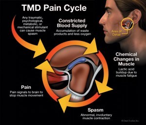 What Causes TMD