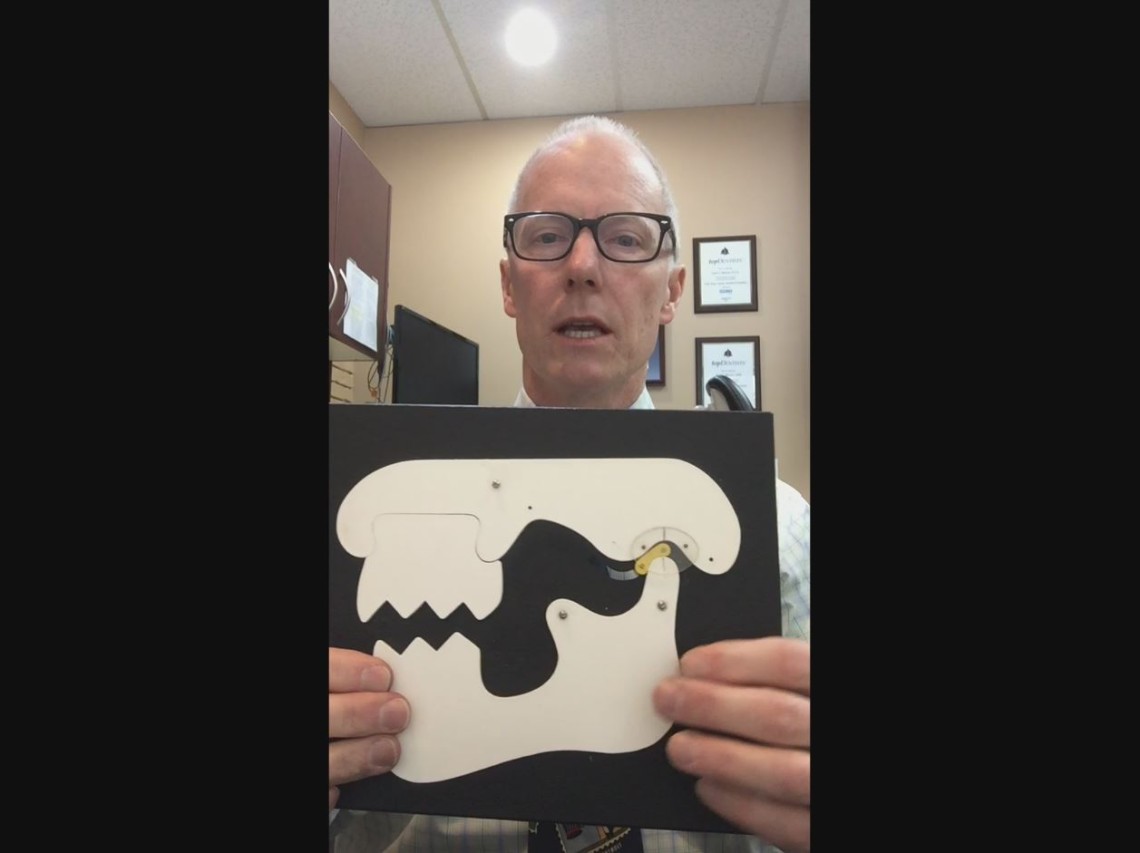 TMJ Jaw Clicking & Lock Jaw Explanation Video