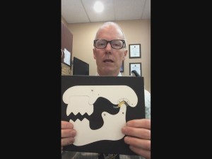 TMJ Symptoms Jaw Clicking Lock Jaw