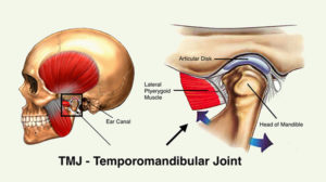 Temporomandibular Joint Disc